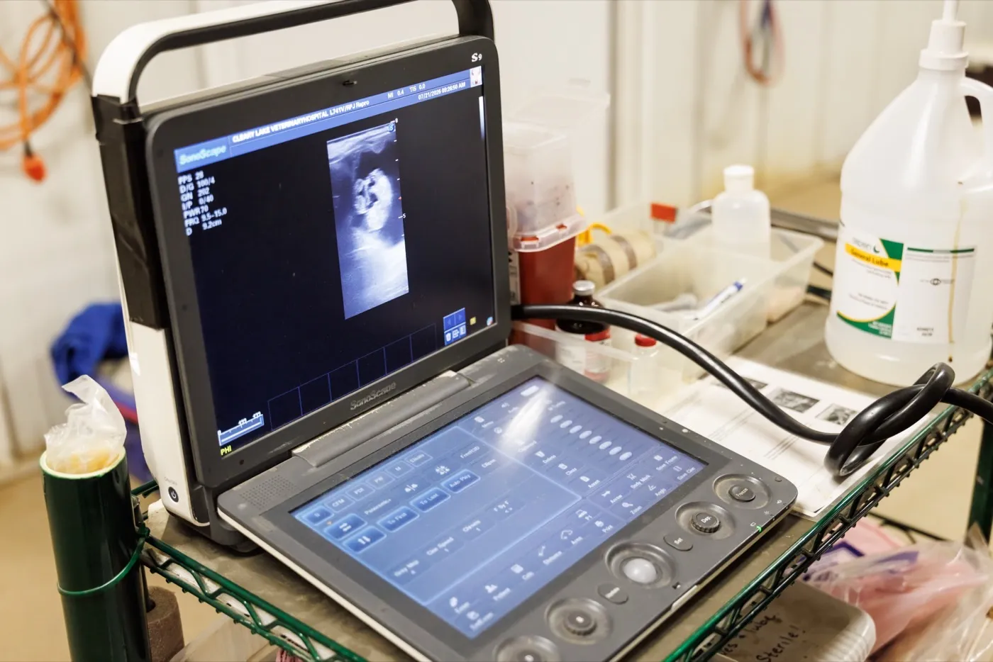 Ultrasound monitor showing a reproductive scan